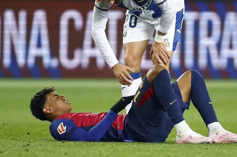 برشلونة يصدم الاتحاد الإسباني بشأن إصابة لامين يامال